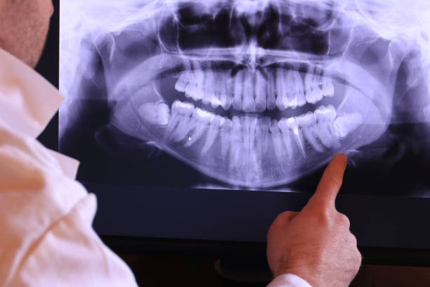 Best Emergency Tooth Extraction in Silver Bay, MN